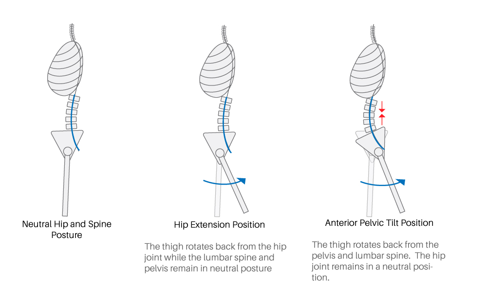 hip extension mobility_hip extension vs APT